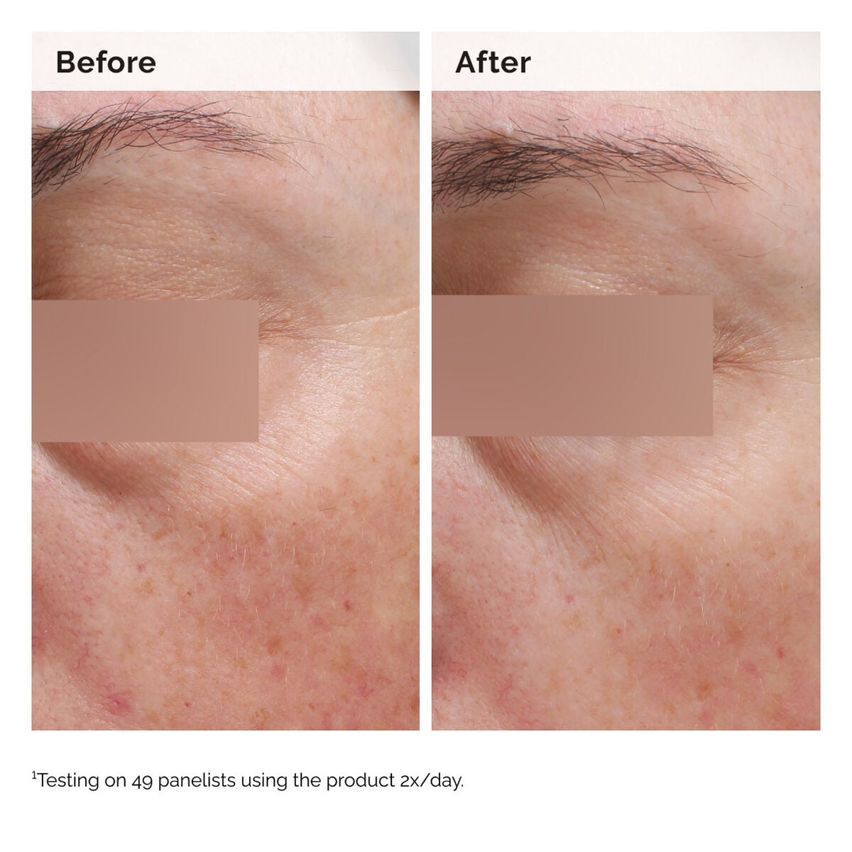 Niacinamide 5% Face and Body Emulsion W2 image 8