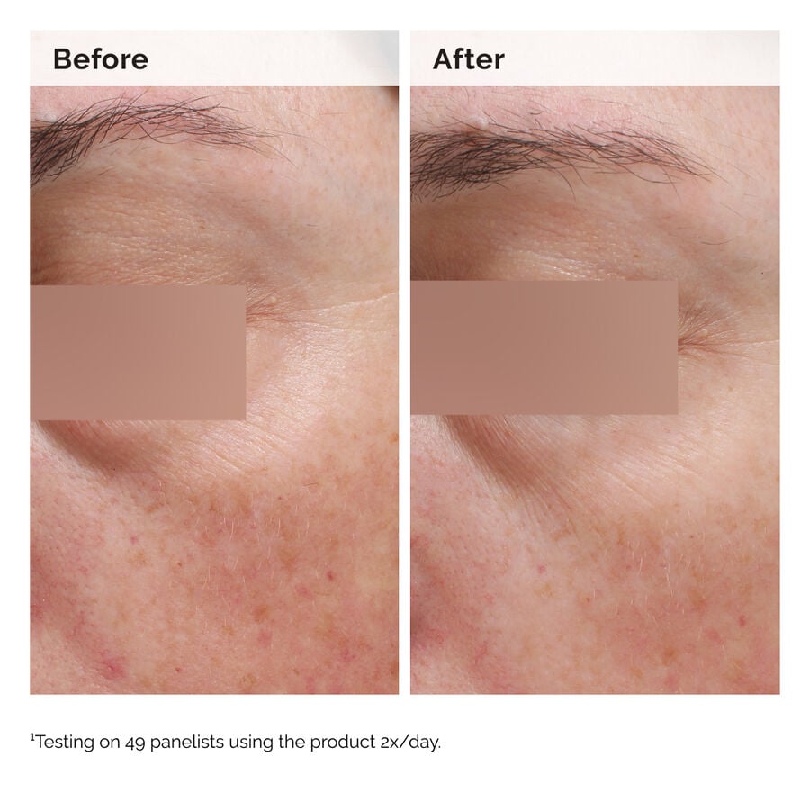 Niacinamide 5% Face and Body Emulsion W2 image 3