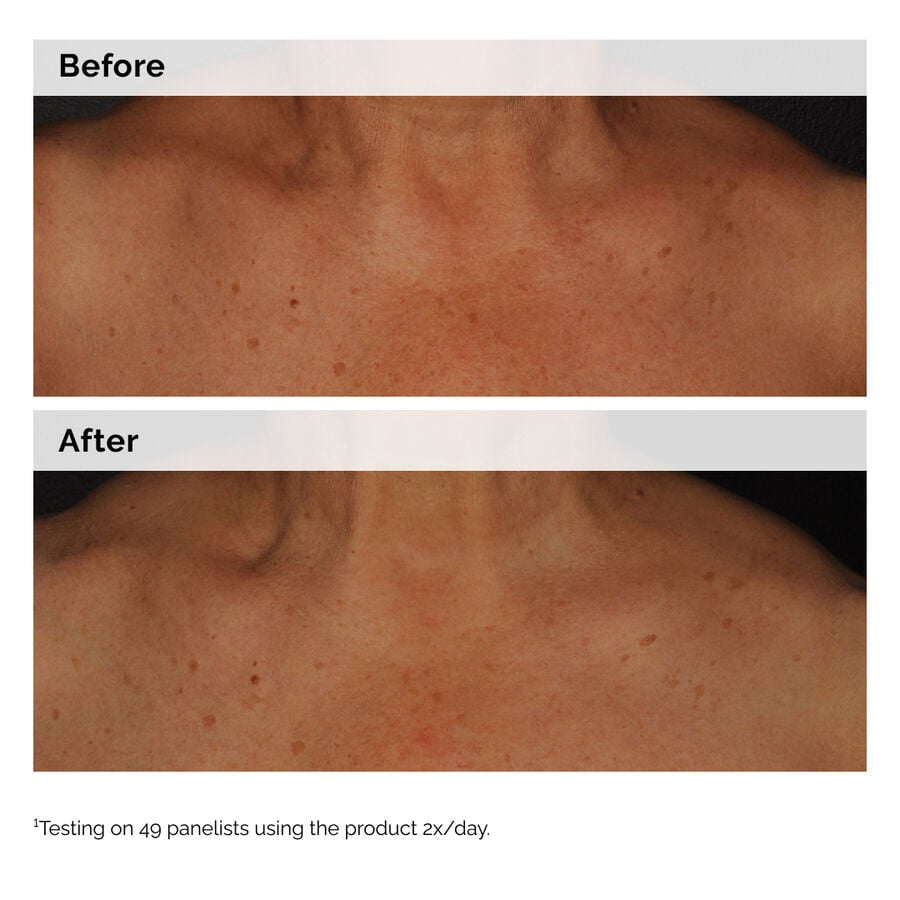 Niacinamide 5% Face and Body Emulsion W2 image 2