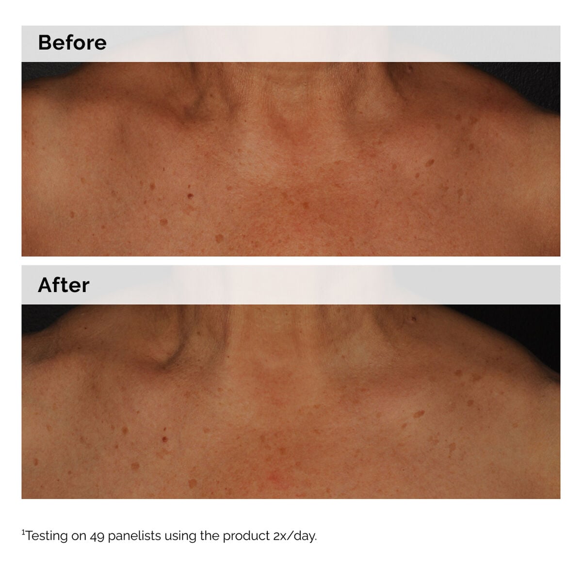 Niacinamide 5% Face and Body Emulsion W2 image 7
