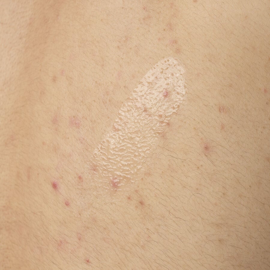 Salicylic Acid 0.5% Body Serum W5 image 4
