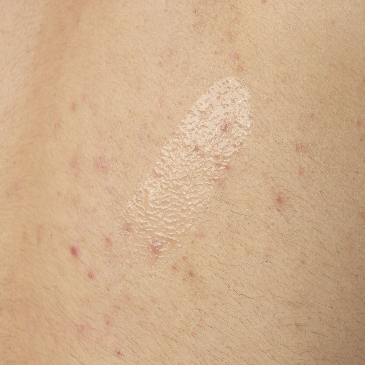 Salicylic Acid 0.5% Body Serum W5 image 8
