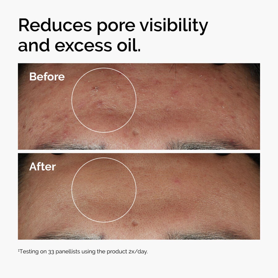 Niacinamide 10% + Zinc 1% U8 image 4