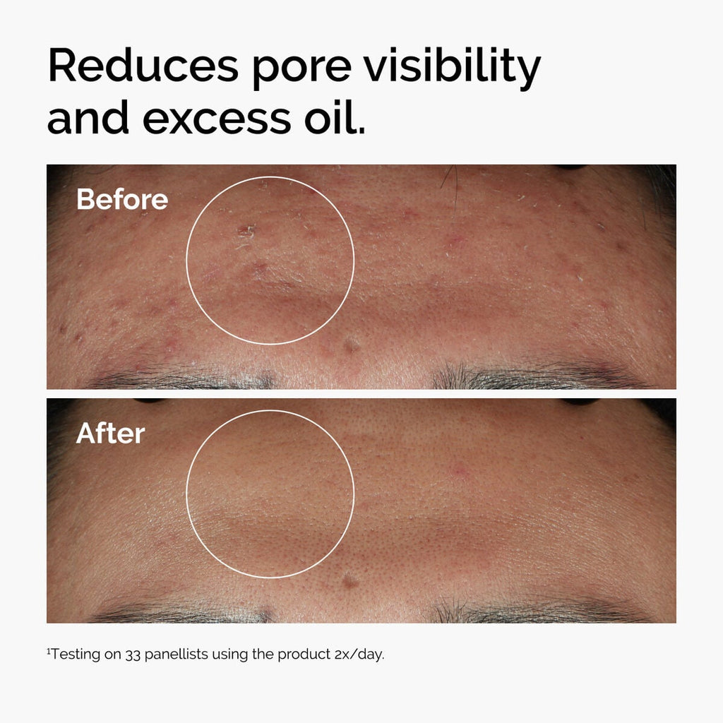 Niacinamide 10% + Zinc 1% U8 image 10