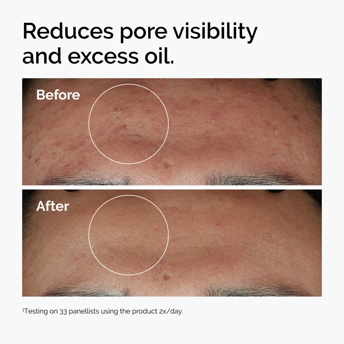 Niacinamide 10% + Zinc 1% U8 image 10