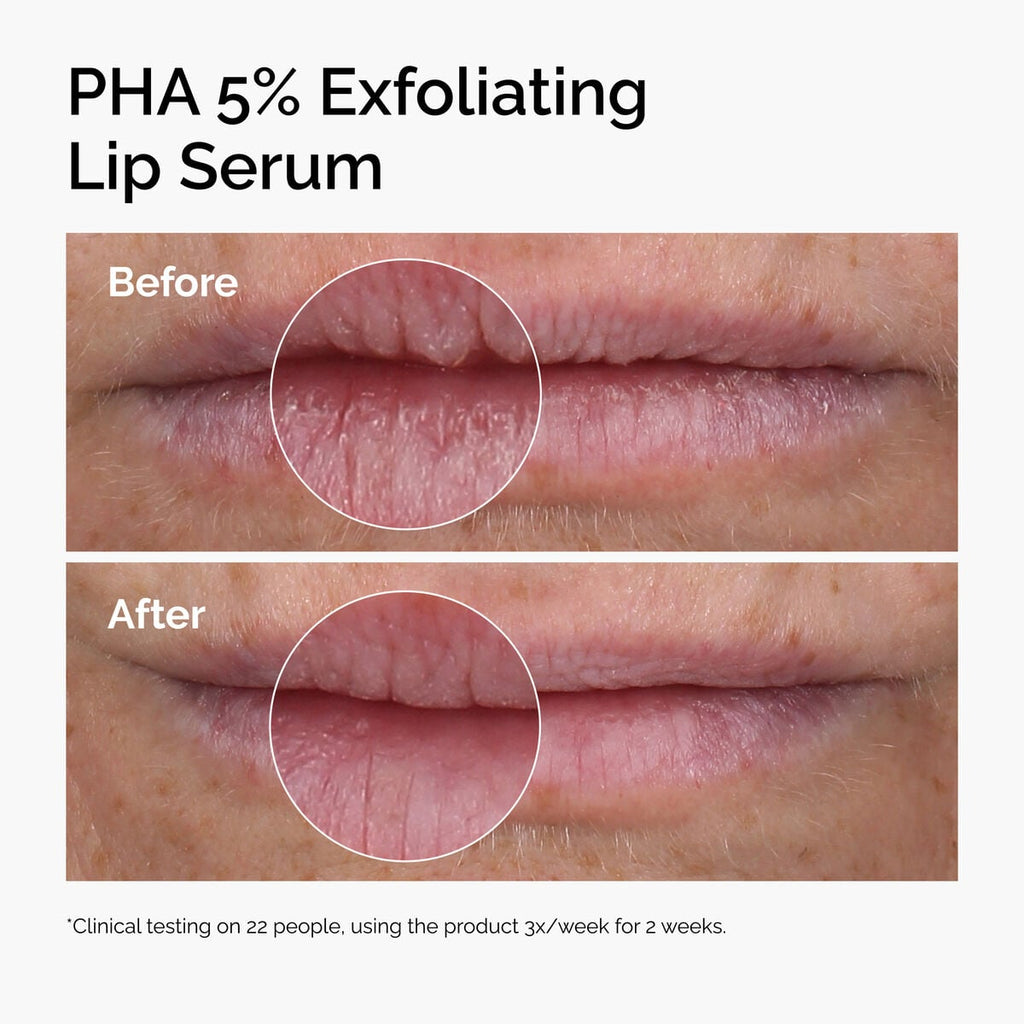 PHA 5% Exfoliating Lip Serum E5 image 9