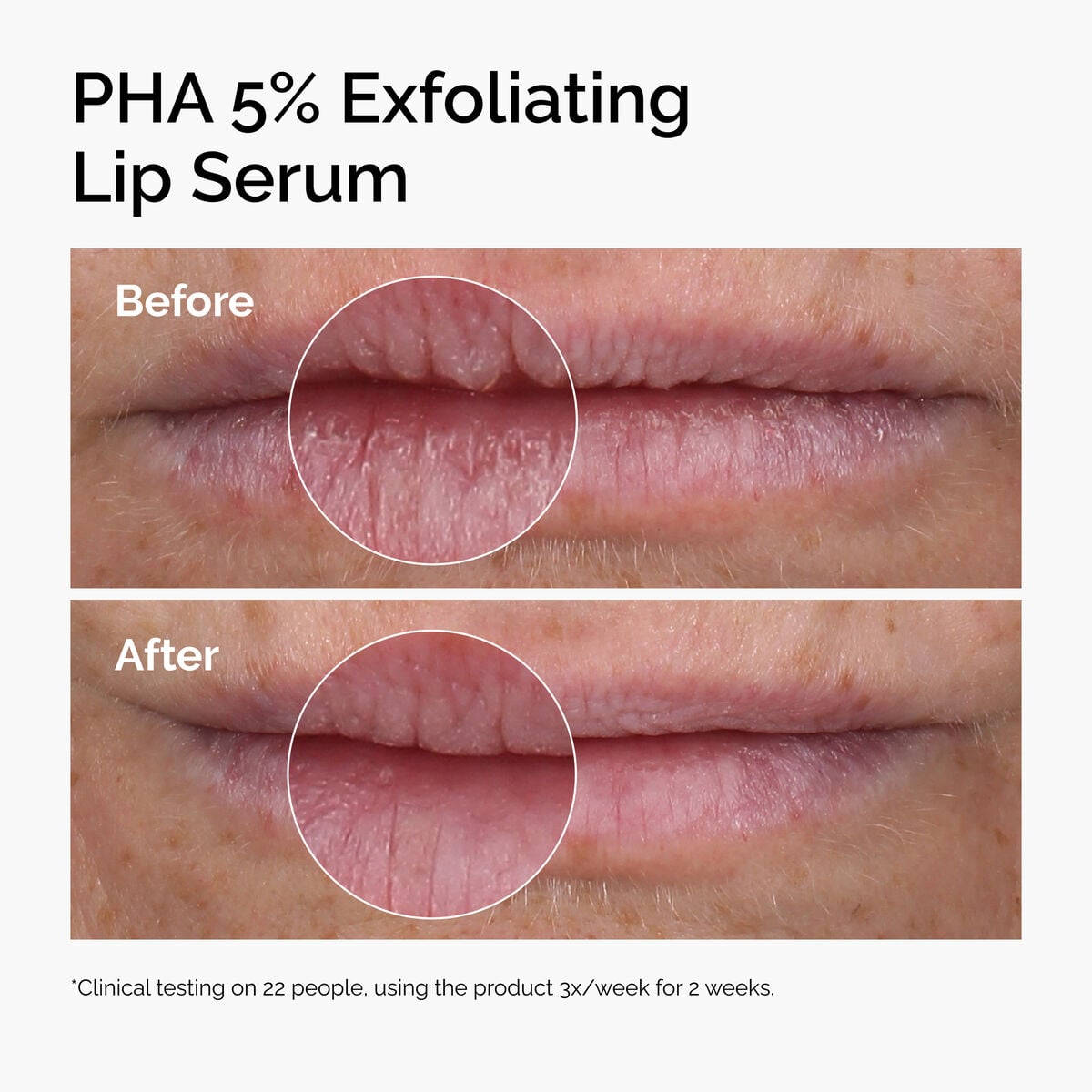 PHA 5% Exfoliating Lip Serum E5 image 9