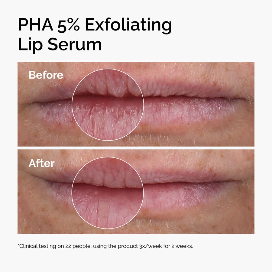 PHA 5% Exfoliating Lip Serum E5 image 3