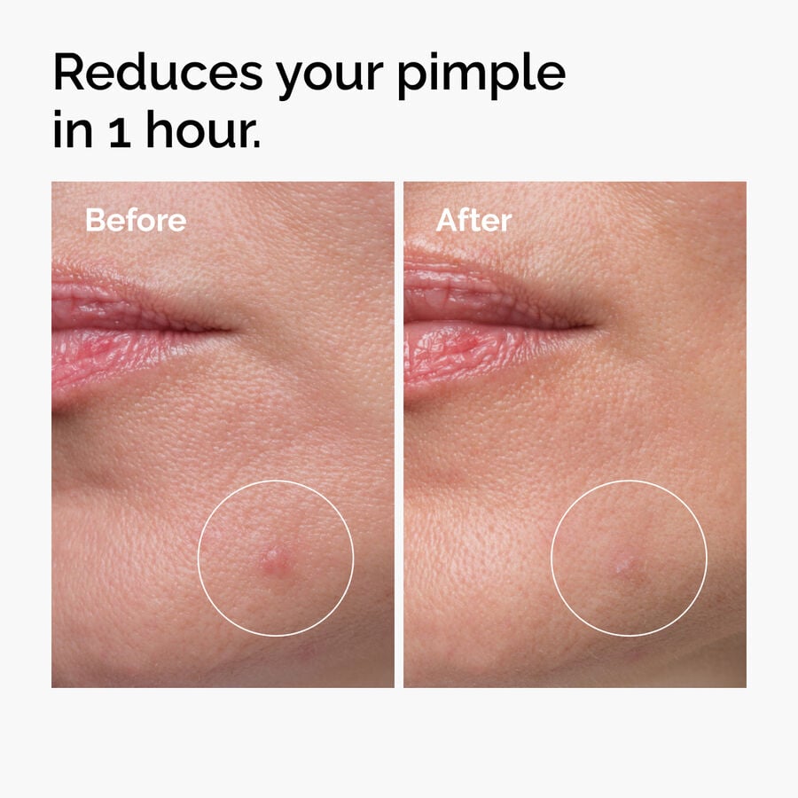 Sulfur 10% Powder-to-Cream Concentrate U1 image 3